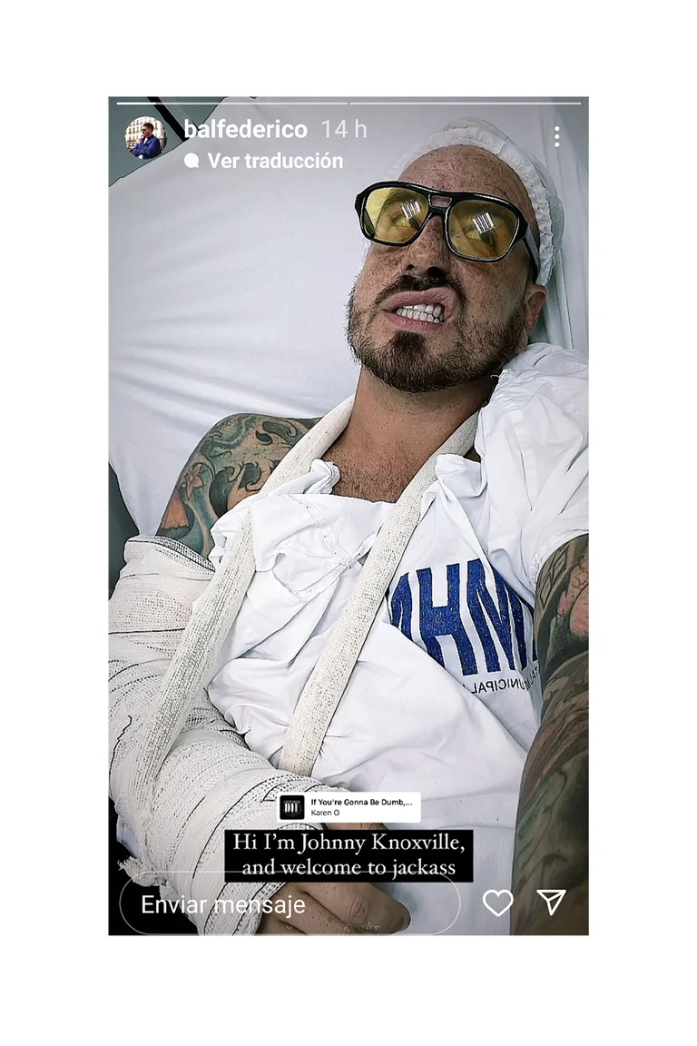 Fede Bal habló luego del tremendo accidente que sufrió en Brasil: “Fue como una película”