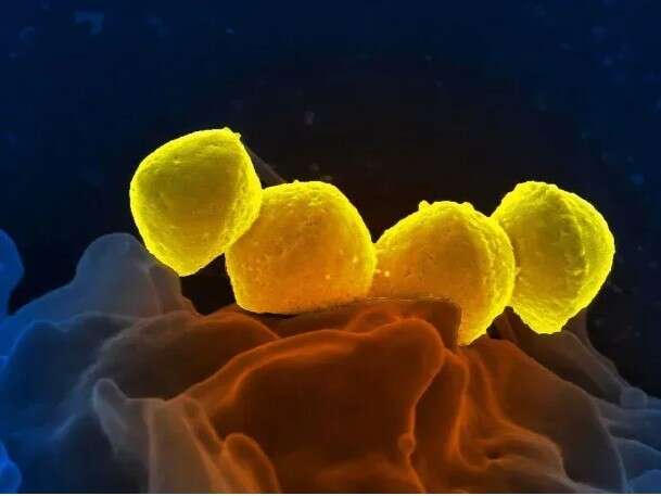 Streptococcus pyogenes: aumentan los casos y ya hay 93 muertos