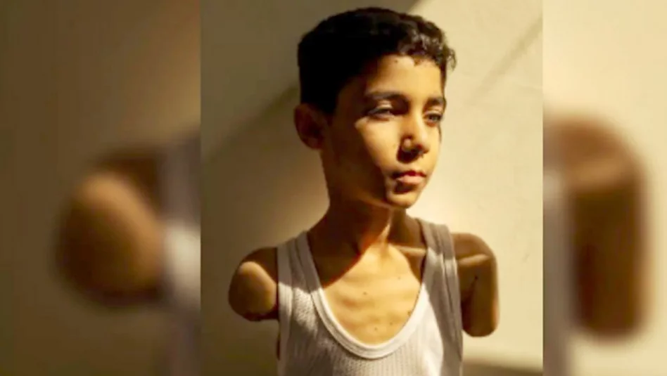 Una imagen que conmueve al mundo: niño mutilado en Gaza es la Foto del Año 2025