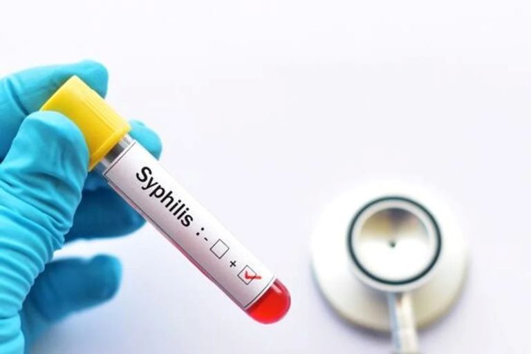 La Pampa entre las provincias del sur con mayor tasa de sífilis